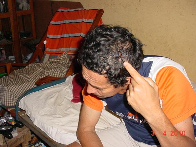 Norman Adolfo Jimenez Guadamuz muestra herida en la cabeza